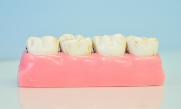 Implanty zębowe i nowoczesna stomatologia